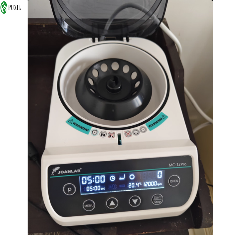 AB plasma centrifuge laborator - Blood Collection Tube recensie en prijs