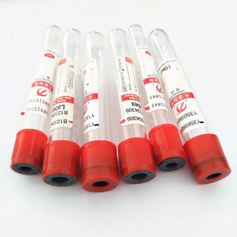 100 Stks/partij 3Ml 5Ml 10Ml W - Blood Collection Tube recensie en prijs